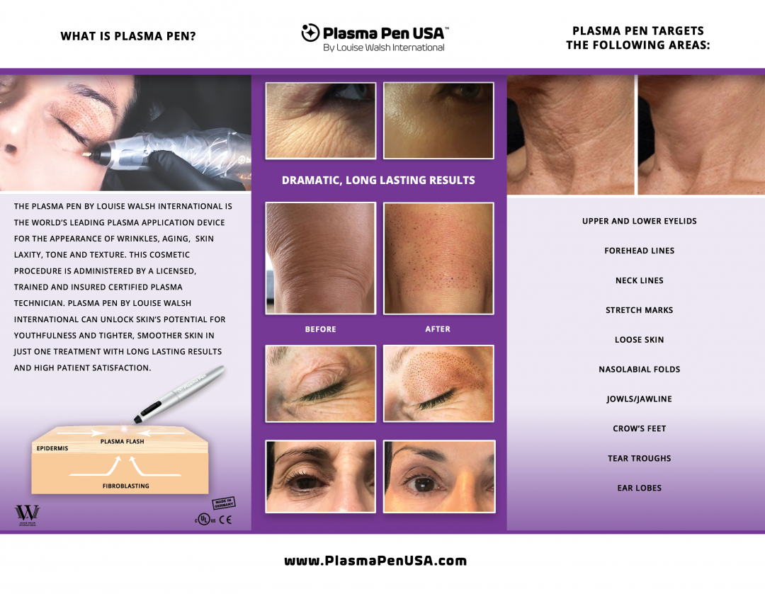 Plasma Pen Fibroblasting Premier Wellness Az